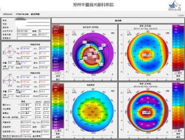 郑州眼科医院全飞秒设备,郑州视光眼科的仪器