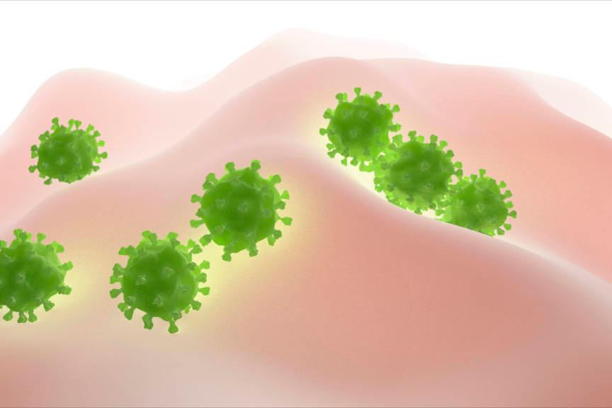 头皮毛囊炎饮食要注意什么,头皮毛囊炎种类和用药