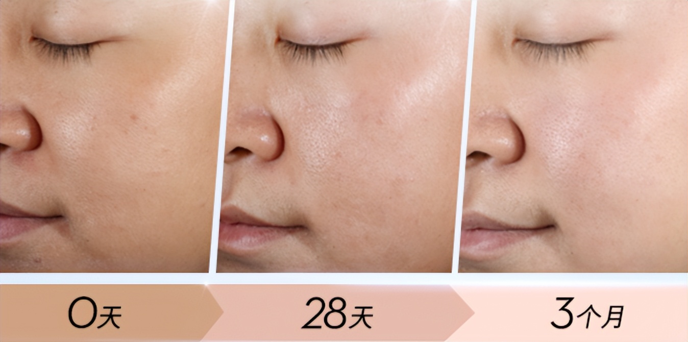 olay玉兰油套盒适合敏感肌吗,olay玉兰油美白水乳套装测评