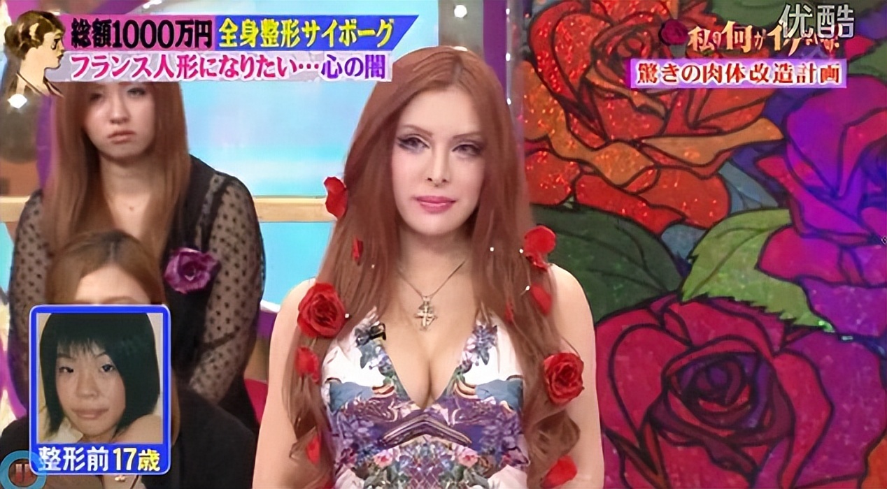 日本网红砸3亿整容上百次！整成法国娃娃：丑八怪在日本活不下去