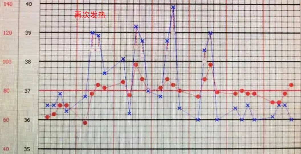 反复发烧但是拍片显示轻微肺炎,一直高烧39-40是肺炎么