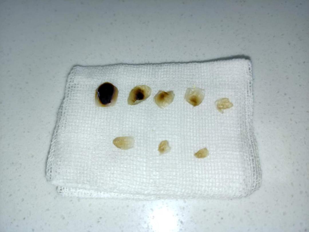 猫角膜溃疡角膜破损的治疗,猫角膜溃烂化脓用什么药