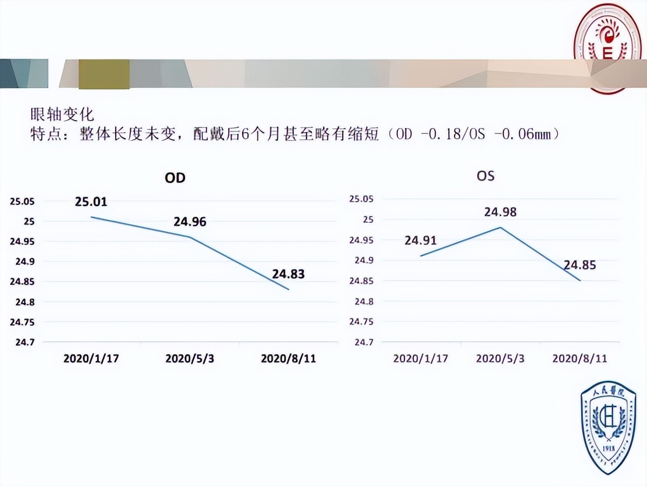 王凯角膜塑形镜原理,王凯医生塑形镜