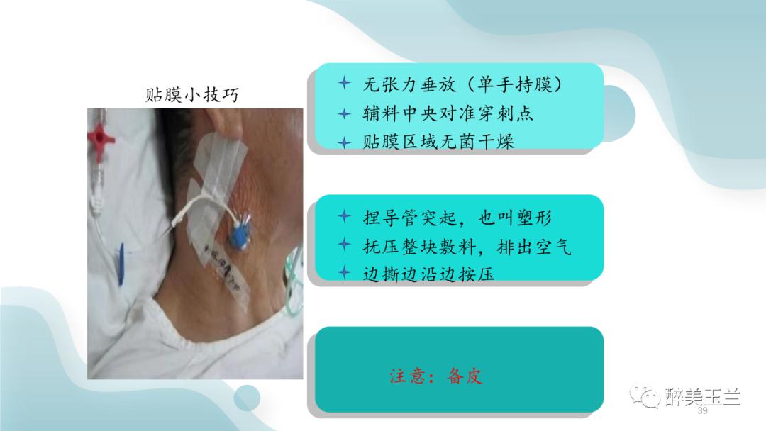 深静脉穿刺置管术讲解ppt,中心静脉穿刺置管深度