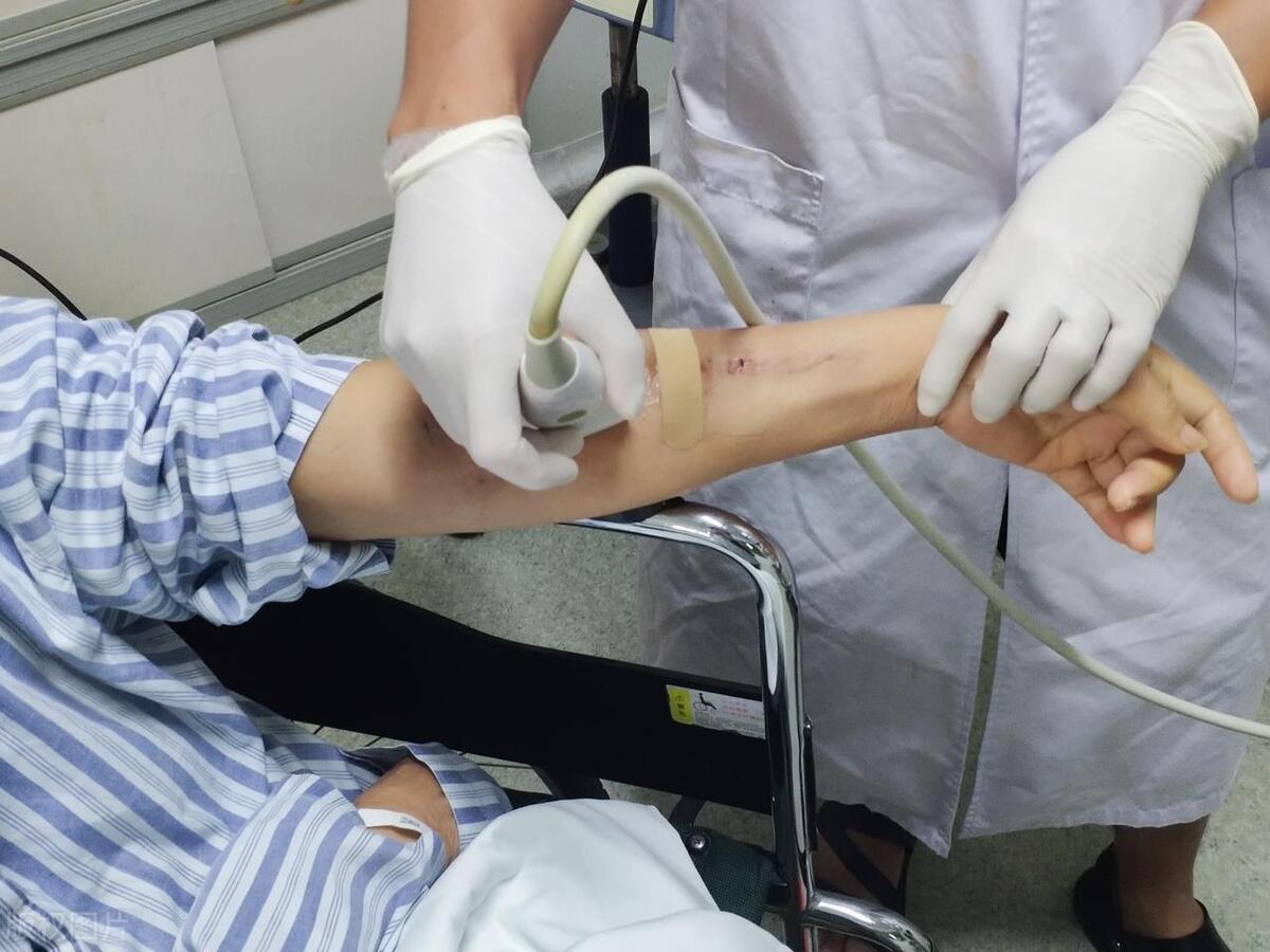 医疗纠纷未鉴定原告死亡,医疗纠纷医院未及时治疗怎么赔偿