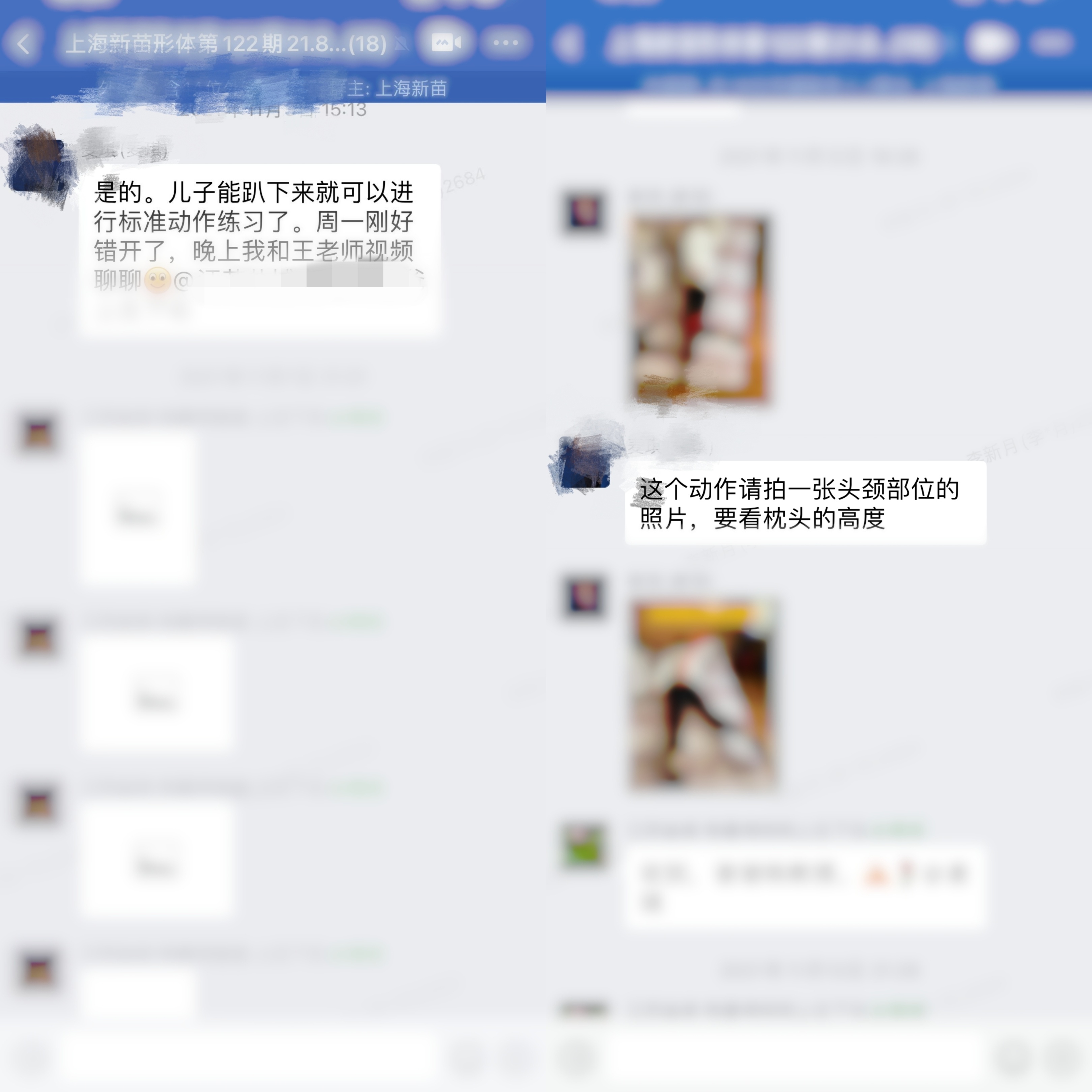 青少年脊柱侧弯如何自我矫正,青少年脊柱侧弯自我矫正