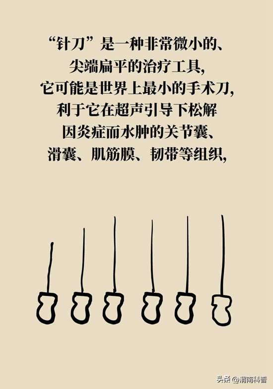 肩膀不抻不疼一抻就疼,肩膀往后伸疼