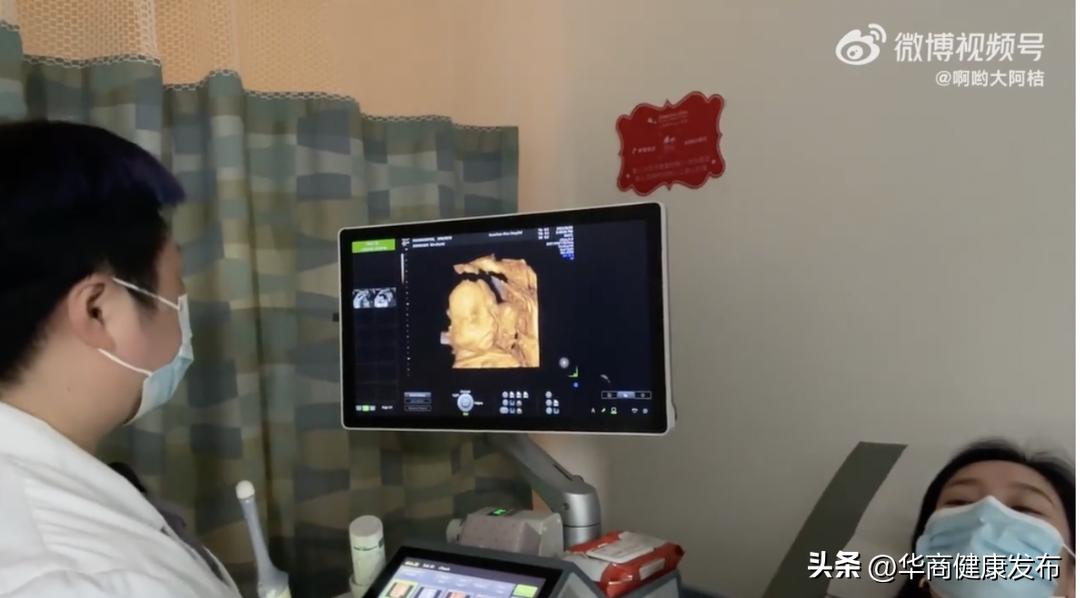 女子冻卵需要什么条件,女子冻卵