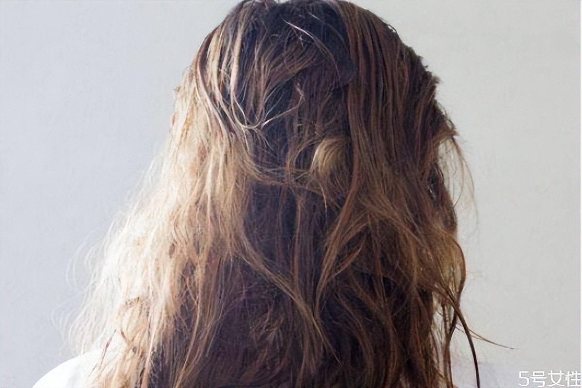 脱发掉发教你三招,脱发掉发的福音