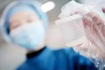 精液检查你所要知道的知识