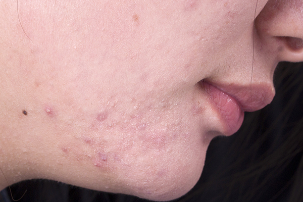 面部是健康的晴雨表,脸是我们身体健康的晴雨表