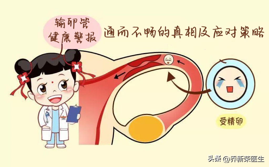 输卵管健康警报：通而不畅的真相及应对策略
