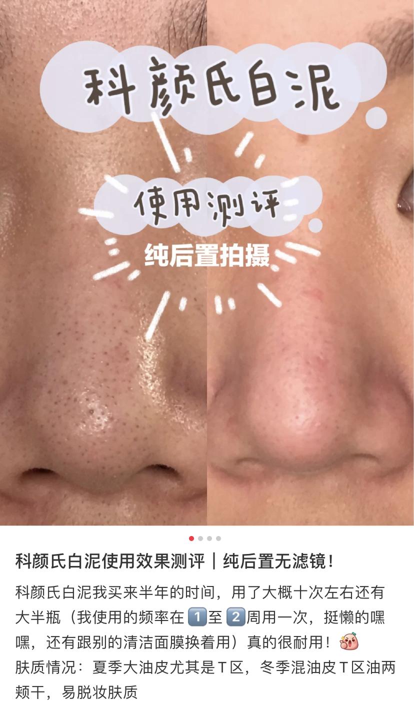 科颜氏白泥面膜清洁去黑头125ml,科颜氏白泥面膜真的能去黑头吗