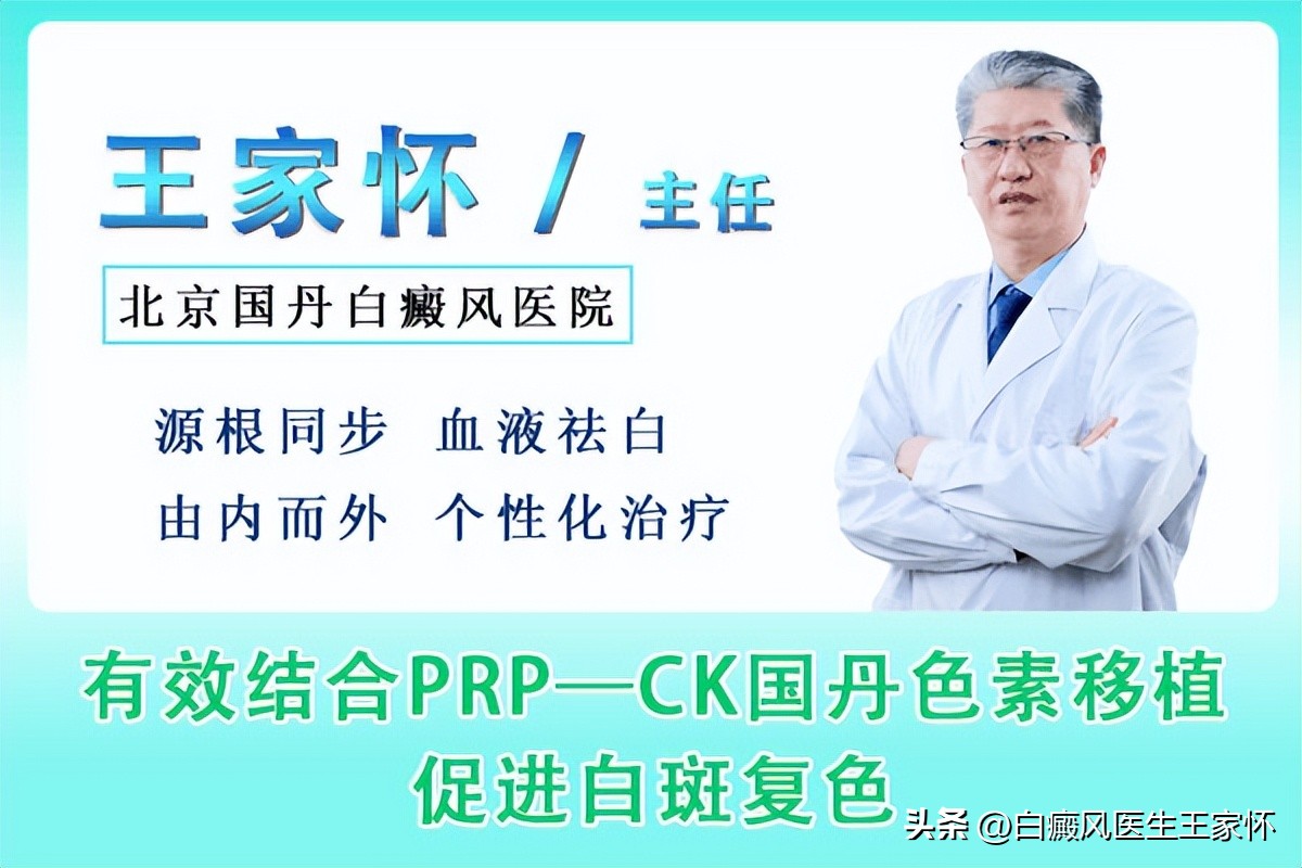 如何阻止白癜风的扩散,如何有效阻止白癜风扩散