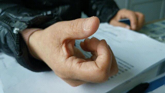 中年妇女手指腱鞘炎是怎么回事,更年期脚拇指腱鞘炎