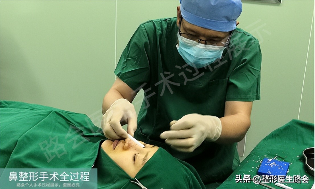 隆鼻手术全过程女生,隆鼻手术到底是怎么进行的