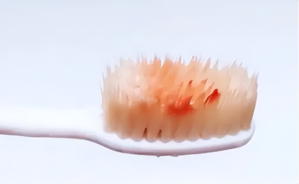 牙刷欧乐b和飞利浦松下,电动牙刷飞利浦松下usmile哪个好