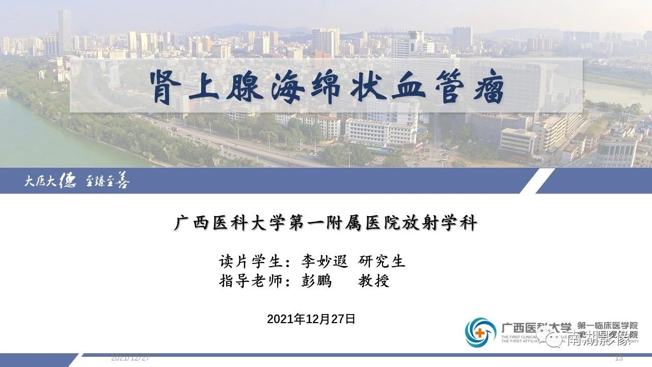 肾上腺海绵状血管瘤,肾上腺血管瘤是良性还是恶性