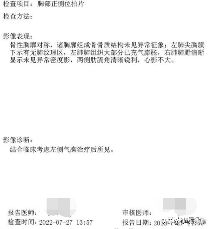 气胸引流呼吸时水柱上下波动,气胸和心脏病的症状有区别吗