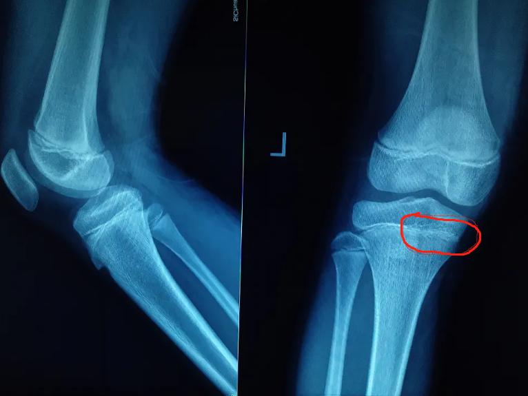 7个常见原因，造成孩子长得又矮又慢，附对应解决办法，家长悉知