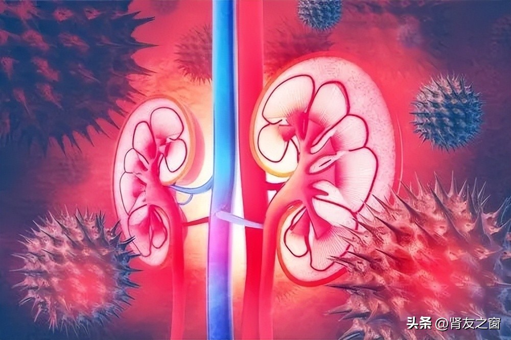 肾盂肾炎怎么治疗最好,肾盂肾炎需要怎样治疗