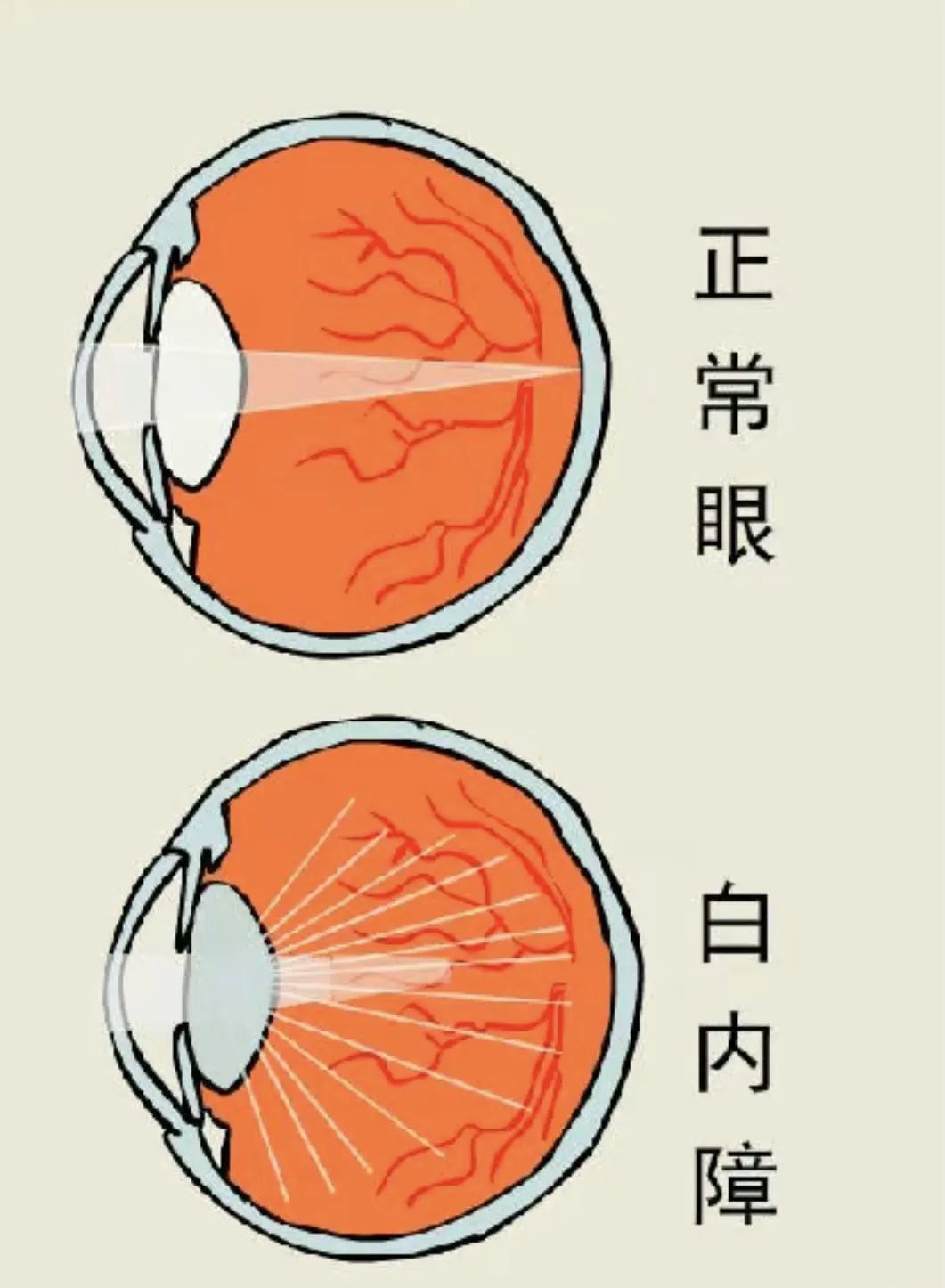 吃什么缓解眼干眼涩眼疲劳,眼干眼涩无神怎么调理最好