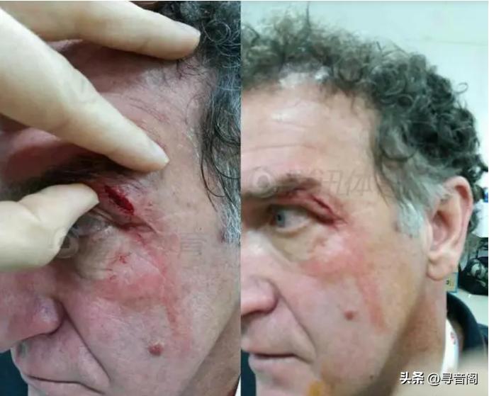 中超赛场盛产攻击型裁判，问题有没有解决方案