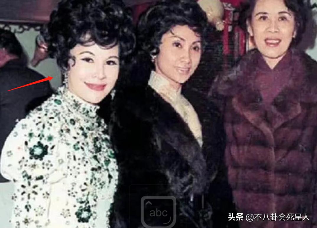 明星整容脸僵硬图片,老女明星整容脸和纯天然脸