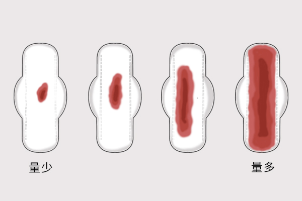 月经干净了几天又出血是怎么回事,46岁月经干净一周又出血怎么办