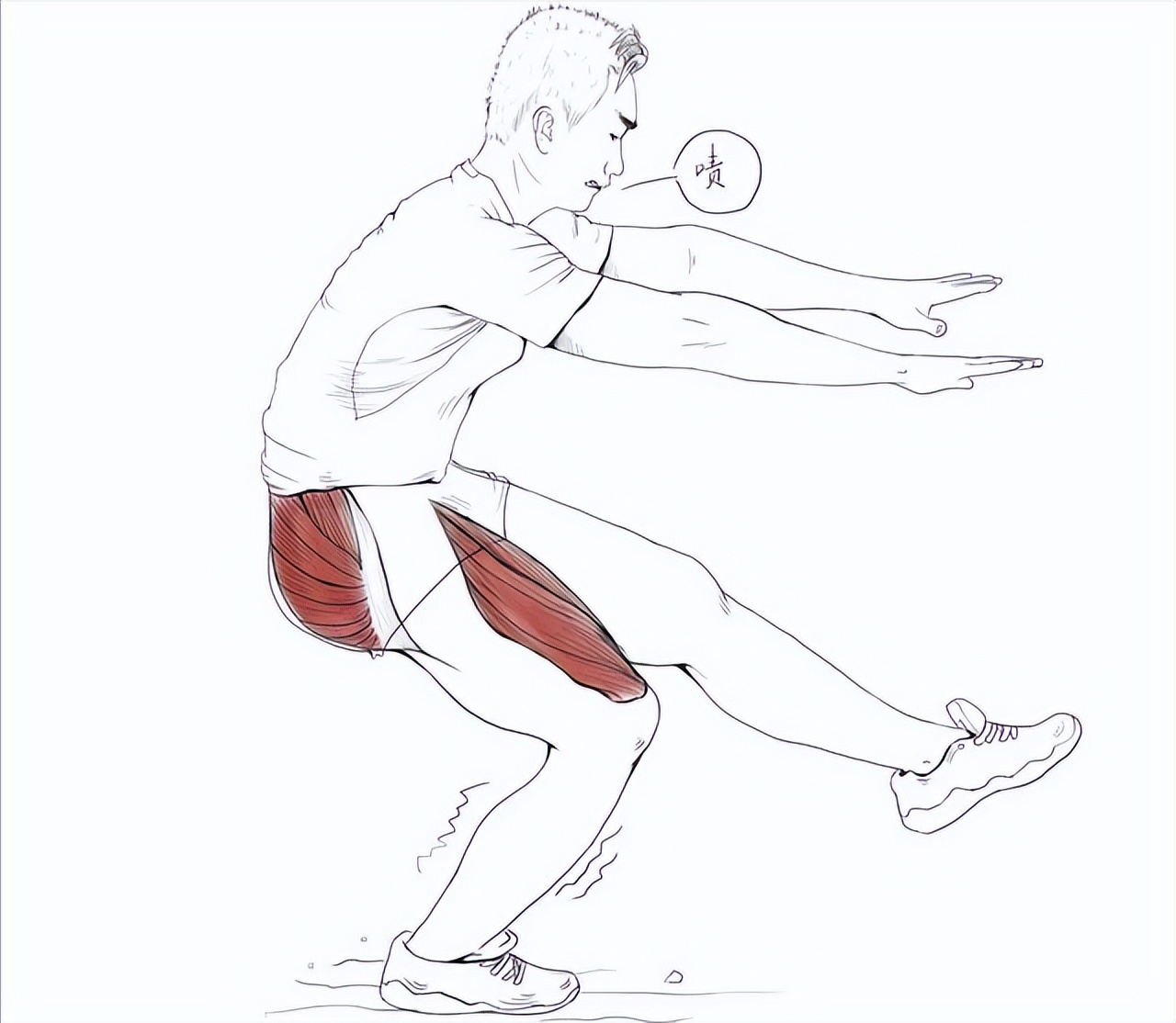 髌骨软化症走路腿发软没劲严重吗,上下楼梯膝盖疼屈膝疼怎么回事