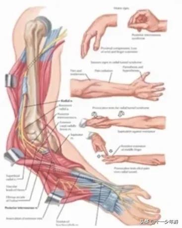 周围神经病和外周神经病,周围神经病