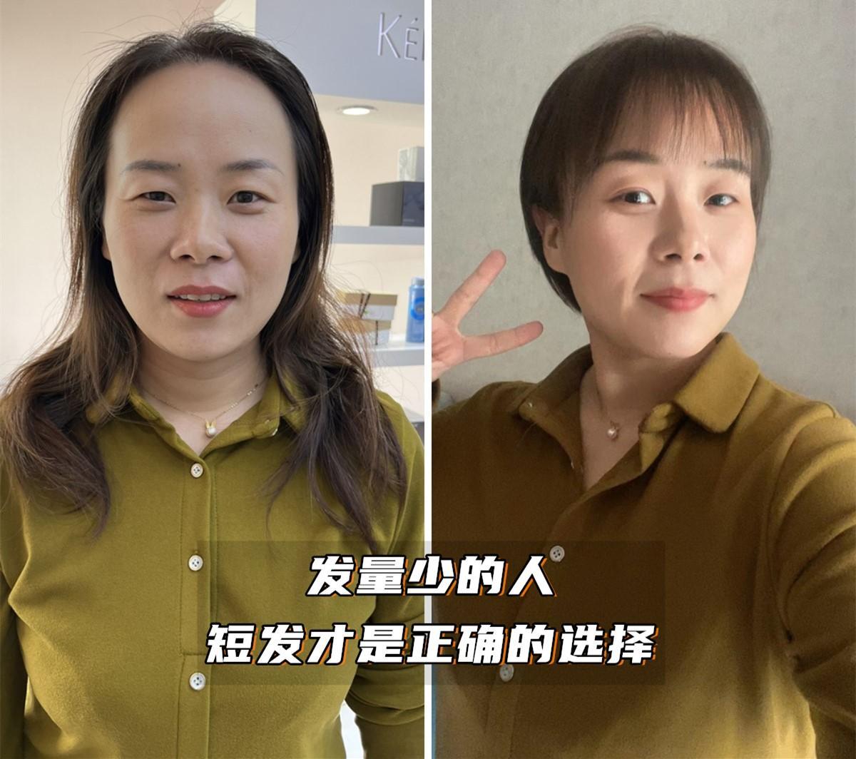 头发的长短稀疏决定衰老的速度,头发稀少又白让人一下子老了几岁