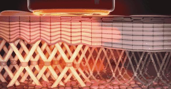 射频紧肤美容,rf射频美容护理