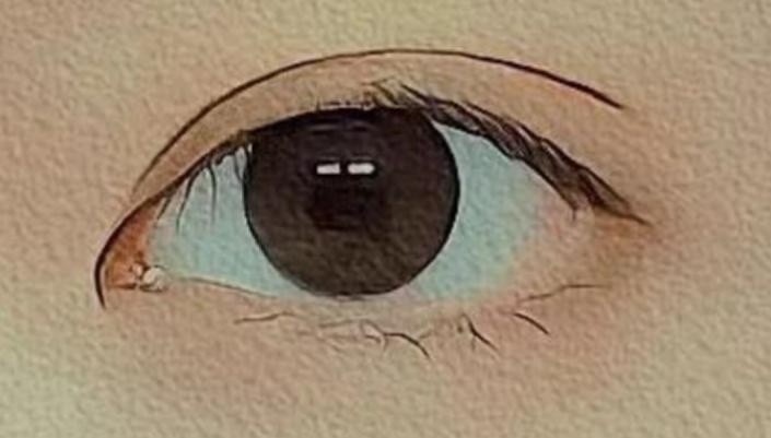 割双眼皮必须了解的知识,割双眼皮你要避开这些坑