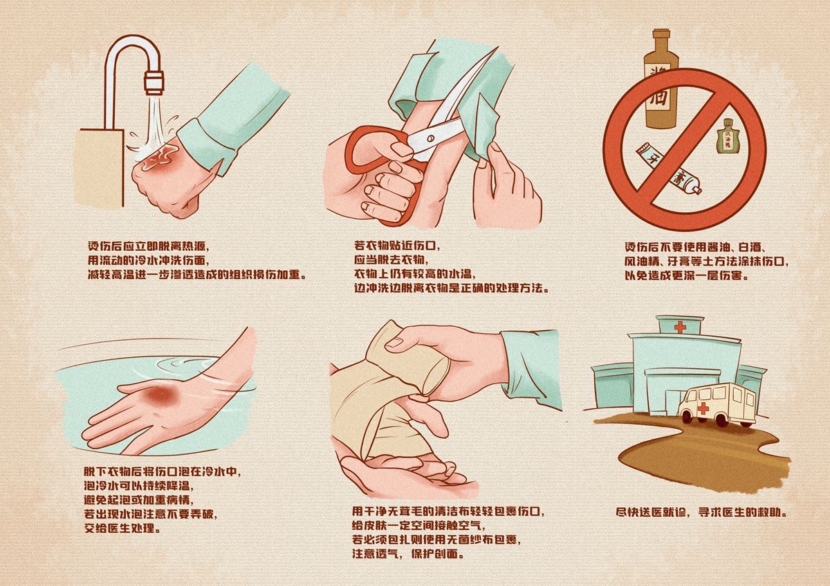 如果孩子被烫伤怎么正确处理,小孩被开水烫伤怎么处理好