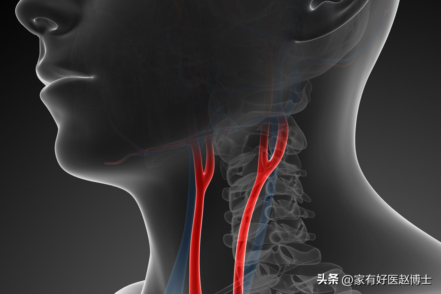 颈动脉没有斑块可以停用他汀吗,一般他汀吃多久颈动脉斑块有效果