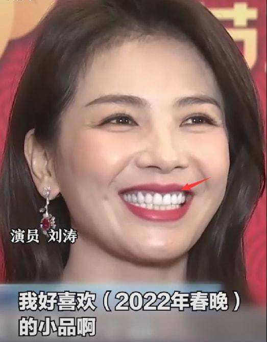 明星做烤瓷牙变凸嘴,明星烤瓷牙凸嘴