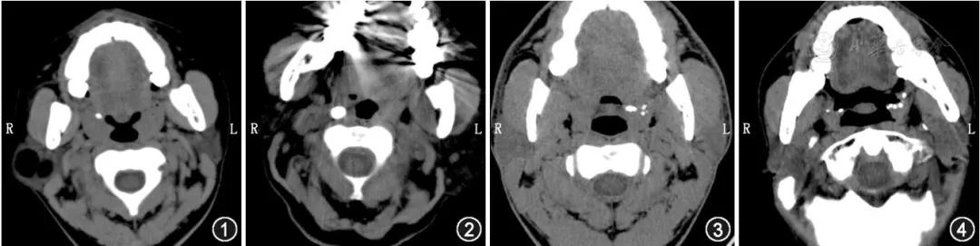 吐出黄色的苦东西咋回事,吐出了黄色绿色的苦水是什么