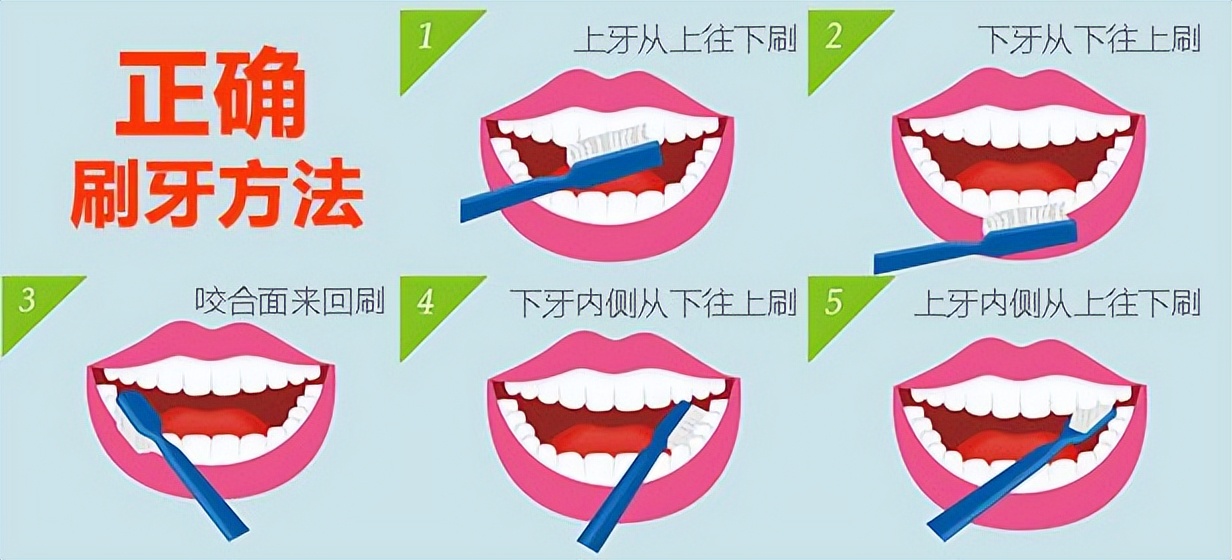 牙龈出血有4种原因是哪些,牙龈出血有4种原因引起