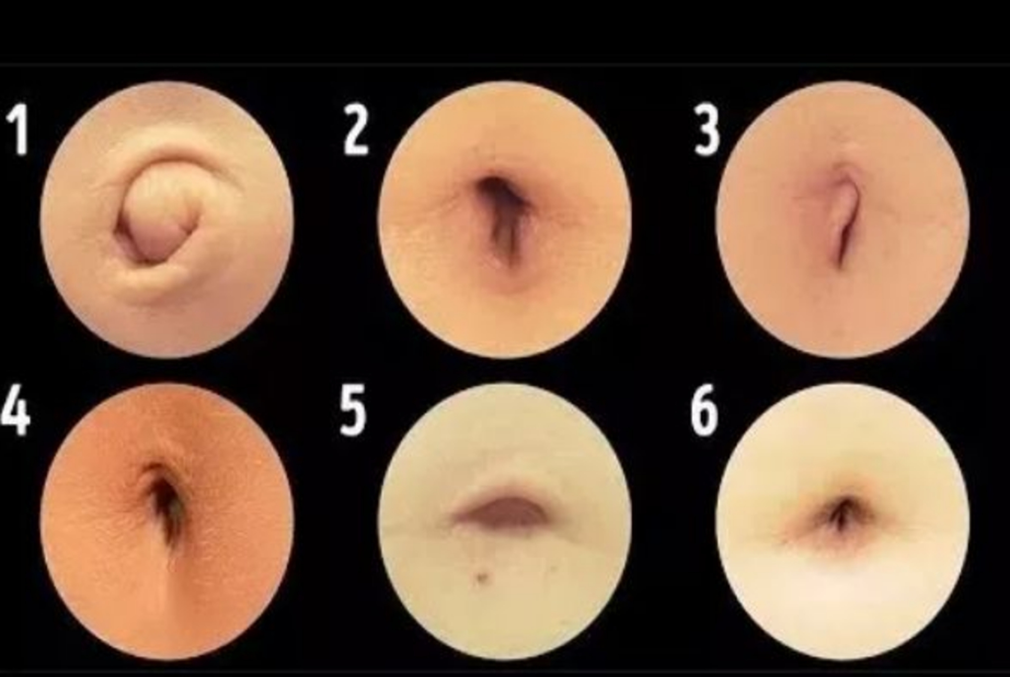 八个月宝宝肚脐眼黑泥怎么清理,宝宝肚脐眼黑黑的泥巴要清洗吗