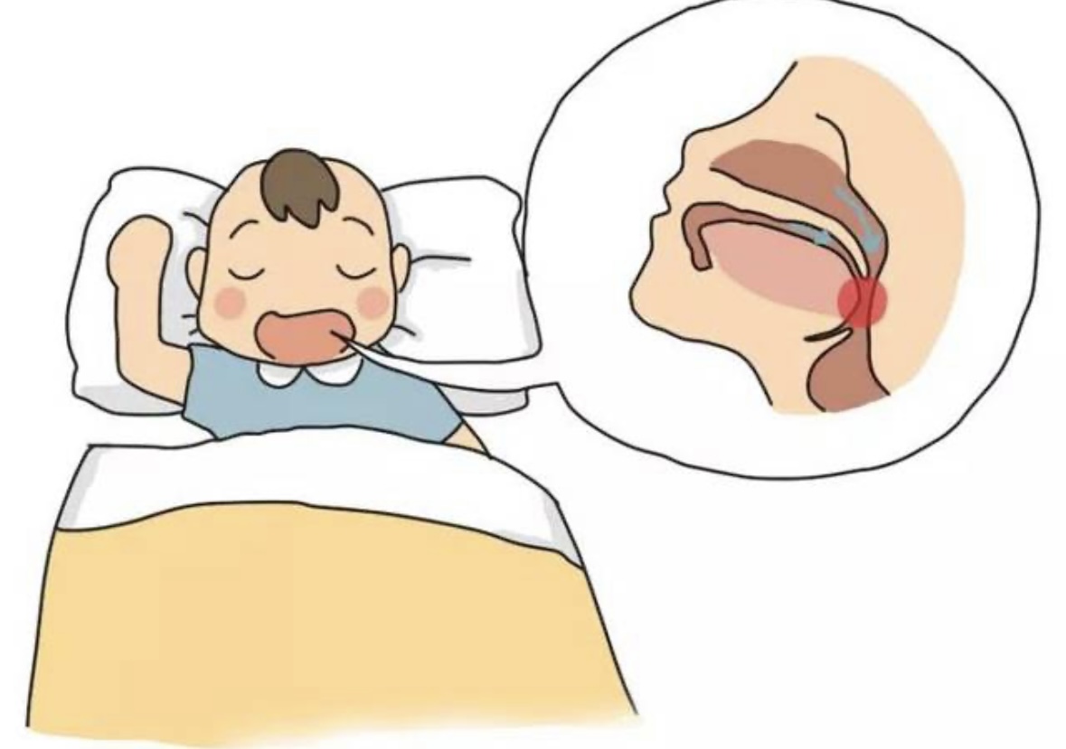 宝宝睡觉用嘴呼吸怎么纠正,宝宝老是用嘴呼吸怎么回事