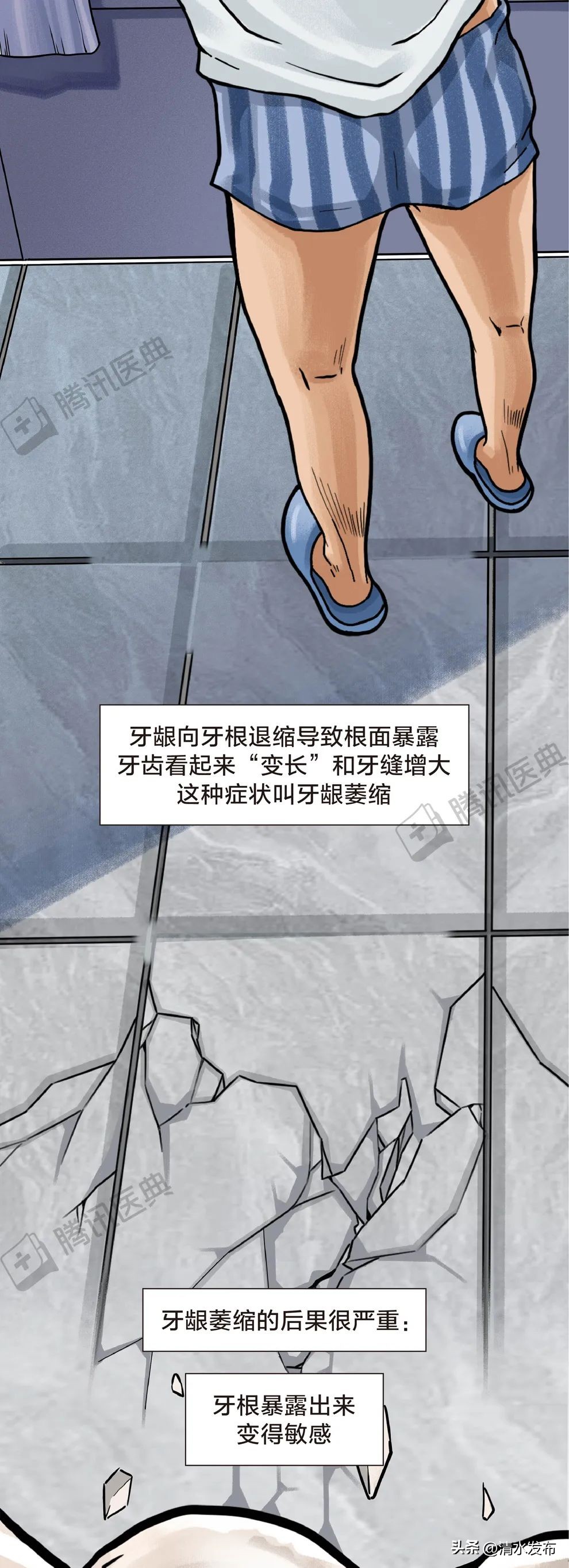 两边大牙一吃肉就塞牙如何修复,14岁学生吃肉老是塞牙需要矫正吗