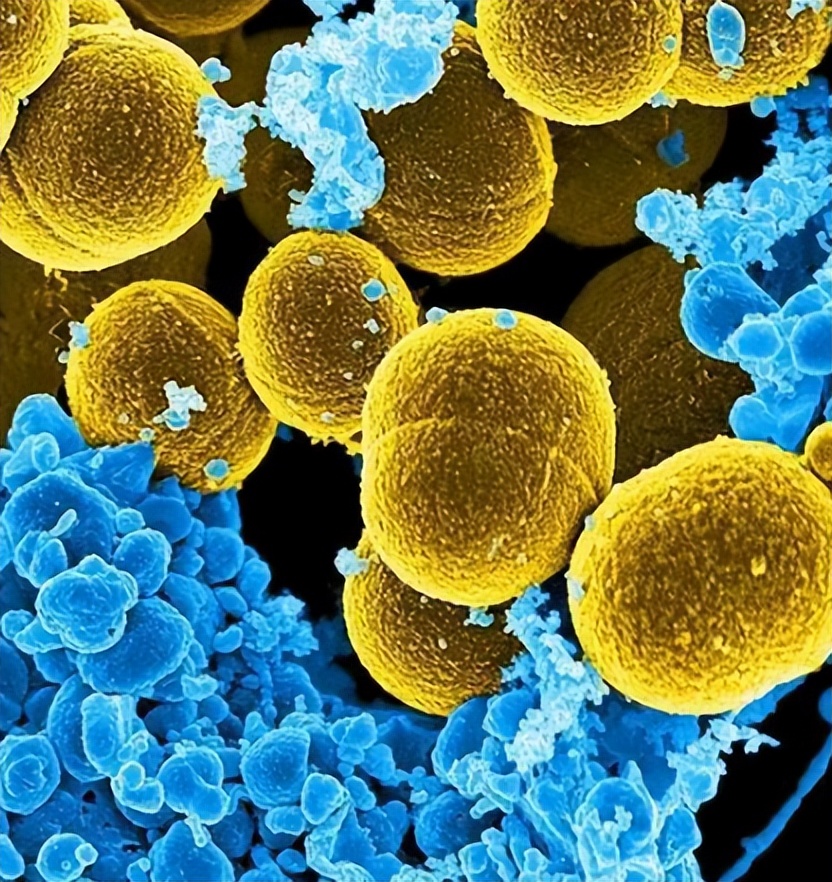 人体抵御细菌感染的第一道防线,人体卫士大战细菌