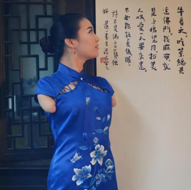 无臂女孩雷庆瑶结婚了吗,无臂女孩雷庆瑶