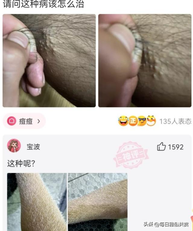 【盐选神回复】请问这种病该怎么治。