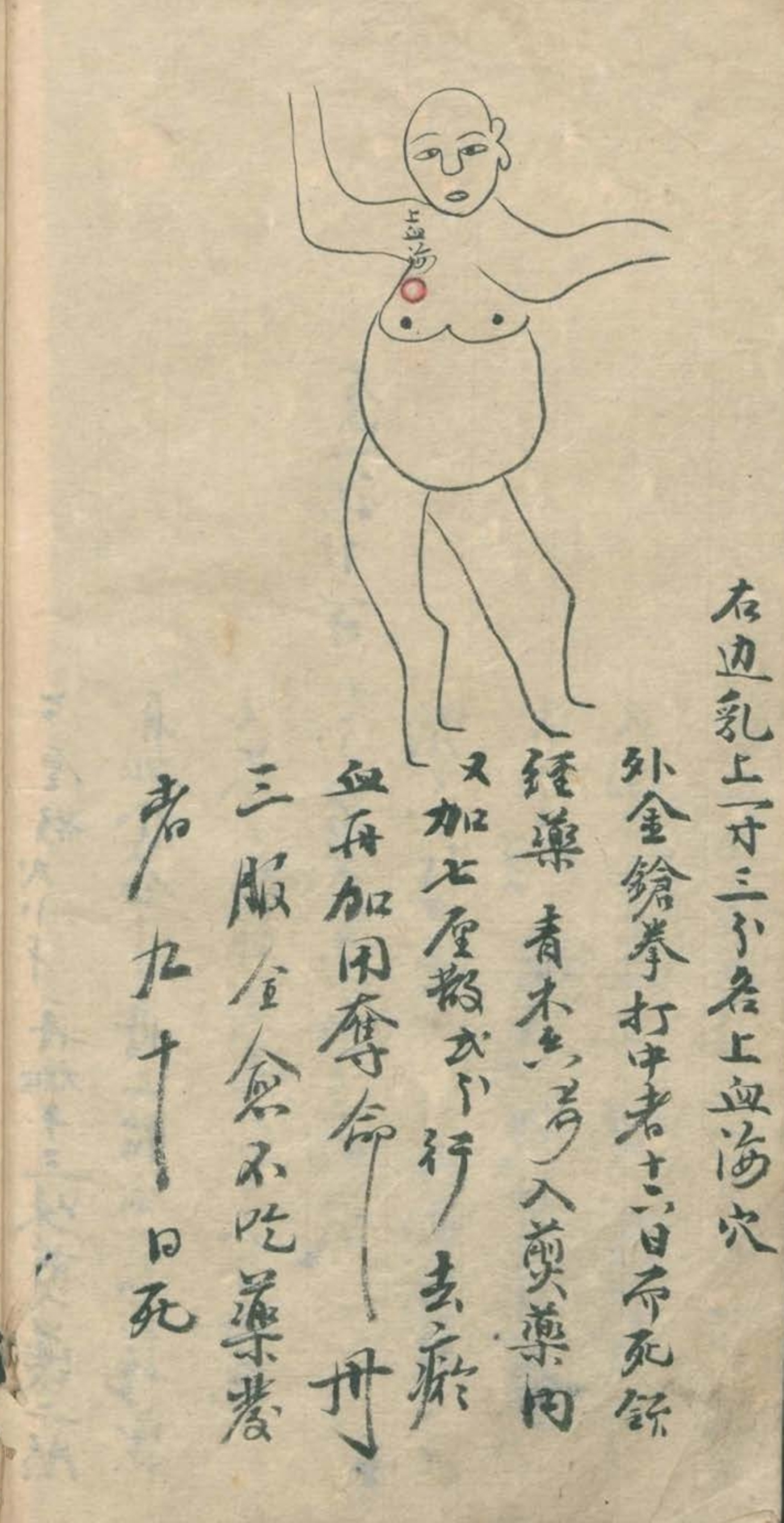 最实用的跌打药方,祖传跌打秘方100首