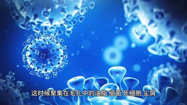 15岁青春期青春痘,青春痘男孩