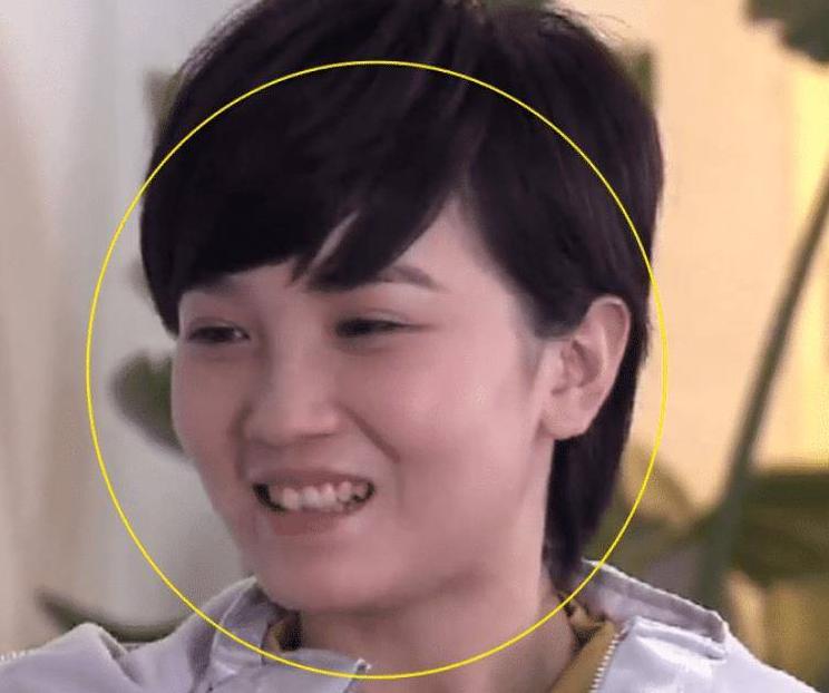 这些整容后都逆袭的女明星,盘点全网那些整容失败的女明星