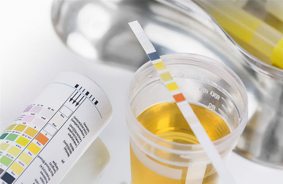 糖尿病肾病出现下肢水肿中医治疗,肾病综合征吃中药消水肿