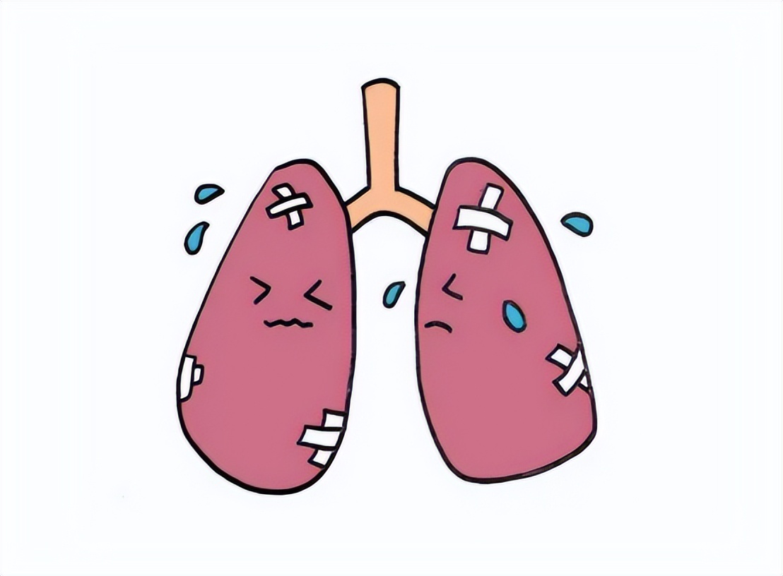 小儿肺炎怎么彻底治疗,小儿肺炎如何彻底治疗